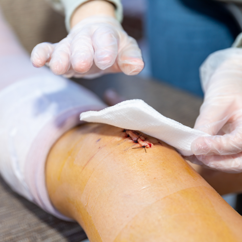 Wound Care